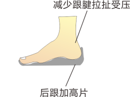 脚跟骨骺炎导致足部疼痛,可以定制矫正鞋进行干预